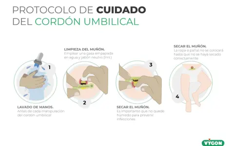 Guía para saber como limpiar el ombligo del bebe: lava manos, limpia el muñón con gasa y jabón neutro, sécalo bien para prevenir infecciones.