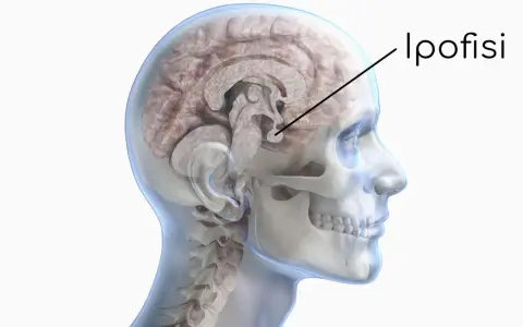 Sezione del cervello umano che evidenzia l'ipofisi. Un tumore ipofisi sintomi può manifestarsi con disturbi visivi o ormonali.