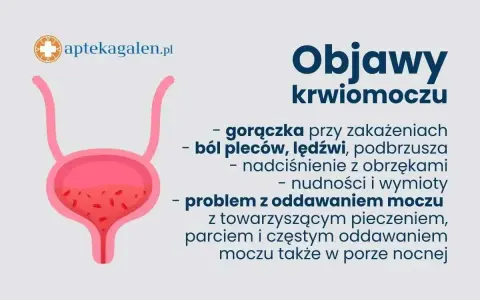 Objawy krwiomoczu: gorączka, ból pleców, nadciśnienie, nudności, wymioty, problem z oddawaniem moczu. Uszkodzenie cewki moczowej objawy mogą być podobne.