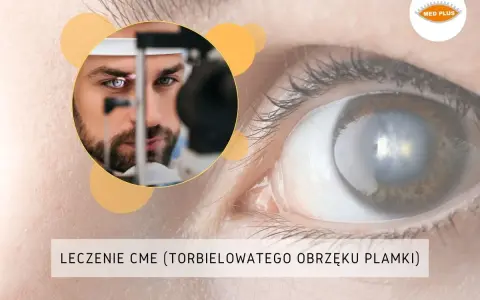 Badanie oka pod kątem makulopatii. Lekarz bada pacjenta, a na pierwszym planie widać oko z widocznymi zmianami.