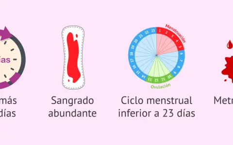 Ilustraciones sobre sangrado premenstrual: duración >8 días, sangrado abundante, ciclo corto (<23 días) y metrorragia.