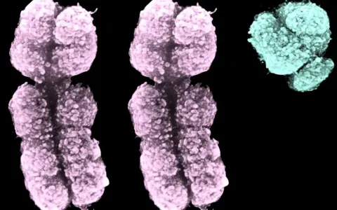 Cromosomi colorati, due rosa e uno turchese, che illustrano la sindrome XXY.