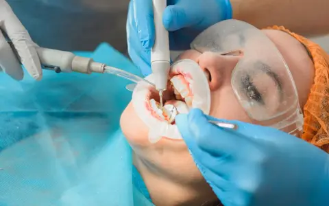 Profesjonalna higienizacja zębów. Dentysta ultradźwiękami usuwa kamień, dbając o zdrowy uśmiech pacjenta.