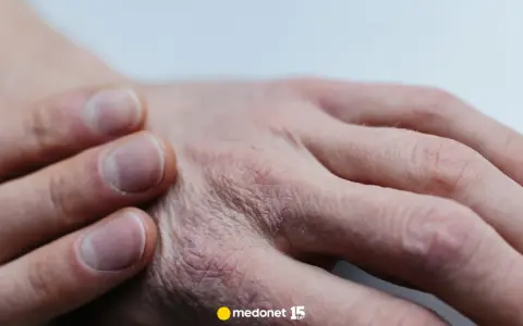 Dezynfekcja: Jak to działa? Unikaj błędów i chroń zdrowie!