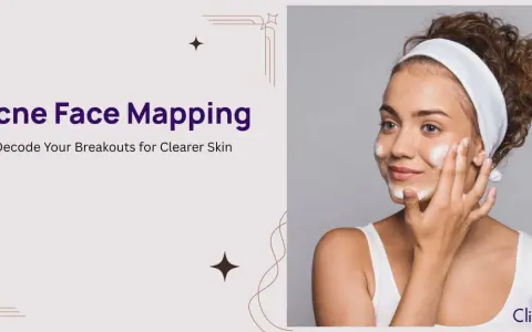 A woman applies foam to her face, illustrating the concept of acne face mapping to understand breakouts.