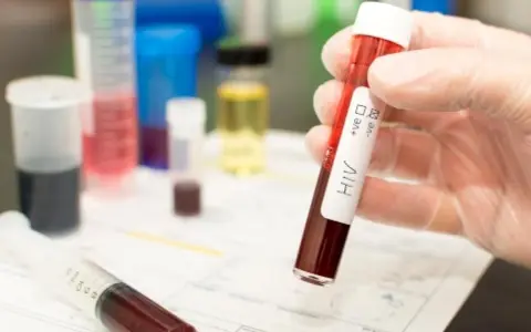 Leczenie HIV w Polsce: Bezpłatne ARV dla każdego? Sprawdź zasady!