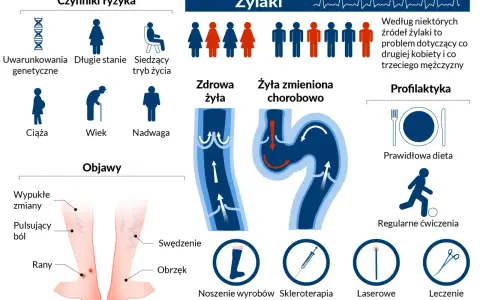 Objawy niewydolności żylnej: wypukłe zmiany, pulsujący ból, rany, swędzenie, obrzęk. Czynniki ryzyka i profilaktyka żylaków.