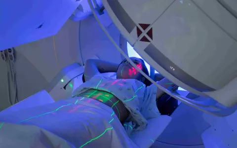 Pacjentka leży pod aparatem do radioterapii, na jej ciele widoczne są zielone i czerwone linie naprowadzające.