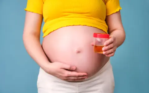Ciężarna kobieta trzyma pojemnik z próbką moczu, badanie na obecność ketonów w moczu w ciąży.