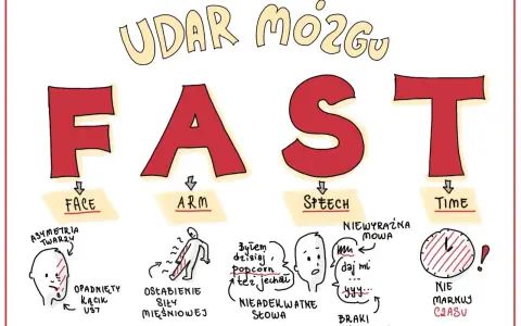 FAST - objawy udaru mózgu: opadnięta twarz, osłabienie ręki, problemy z mową, czas. Odmiana przypadków jest kluczowa.