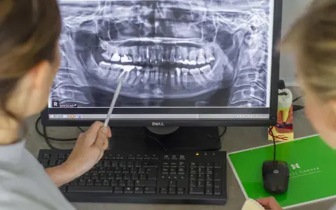 Górna dwójka: Jeden kanał to norma? Sprawdź, co mówi dentysta
