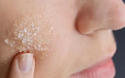 Dito, un dito applica un peeling acido glicolico a casa, con cristalli visibili sulla pelle.