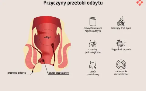 Krew z odbytu: Kiedy do proktologa, a kiedy na SOR?