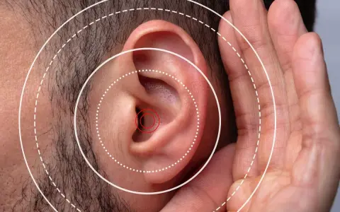 Gros plan sur une oreille humaine avec des cercles concentriques symbolisant le son. Une main est placée près de l'oreille, suggérant une gêne ou une irritation oreille boule quies.