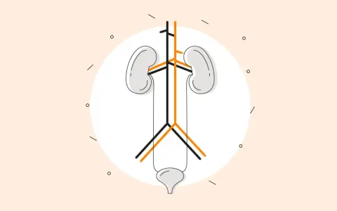 Ilustracja układu moczowego z naczyniami, symbolizująca powikłania dializy otrzewnowej.