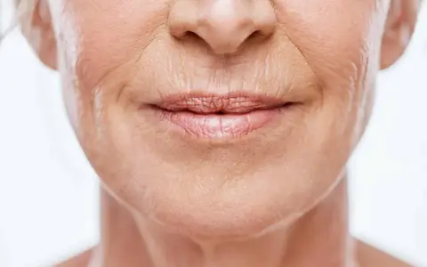 Sehr trockene Haut im Gesicht? Ursachen verstehen, richtig handeln