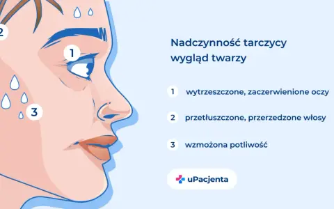 Nadczynność tarczycy objawia się wytrzeszczem oczu (1), przetłuszczonymi włosami (2) i wzmożoną potliwością (3).