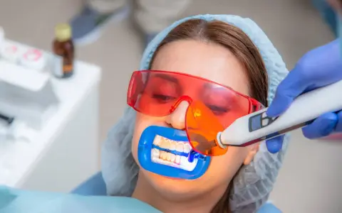 Kobieta przechodzi zabieg wybielania zębów u dentysty. Specjalista używa lampy aktywującej żel wybielający.