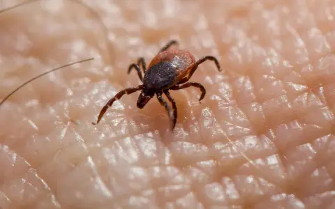 Garrapata en piel humana, un ejemplo de los tipos de garrapatas en España.