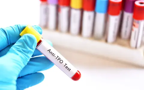 Ręka w niebieskiej rękawiczce trzyma probówkę z krwią do badań immunologicznych u dzieci. Test Anti-TPO.