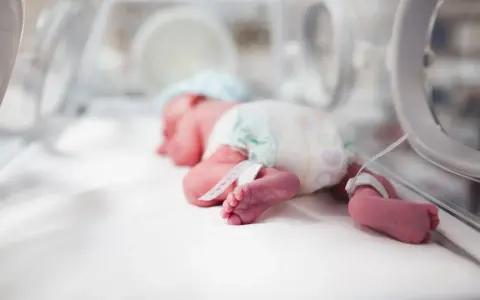 Un bebé prematuro duerme en una incubadora de bebés, con pulseras de identificación en sus tobillos.