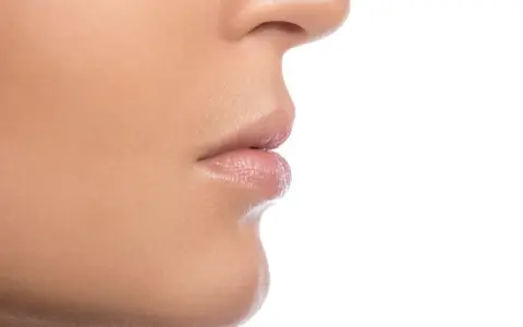 Primer plano de la nariz y los labios de una persona, mostrando la textura de la piel y los filamentos sebáceos en la nariz.