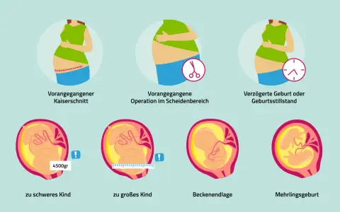 Bilder zum Kaiserschnitt-Ablauf: Narbe, OP im Scheidenbereich, verzögerte Geburt, zu schweres/großes Kind, Beckenendlage, Mehrlingsgeburt.