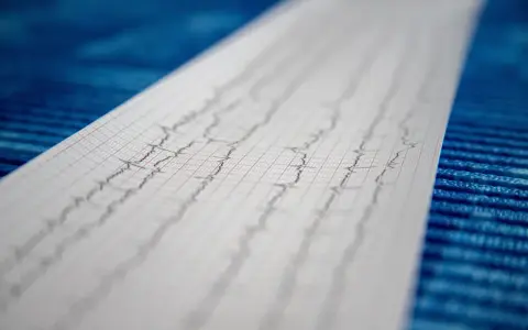 Wynik badania EKG, zapis fal na papierze milimetrowym.