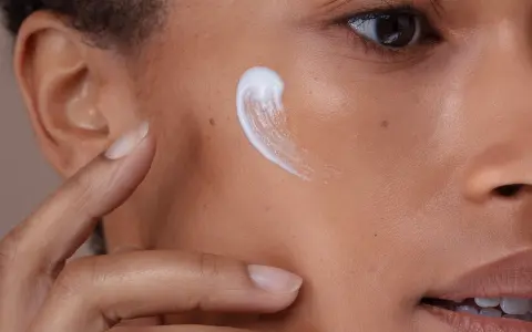 Creme wird auf die Wange einer Person mit fettiger, unreiner Haut aufgetragen.