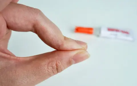 Fingerkuppen kleben zusammen. Ein Röhrchen mit debonder liegt unscharf im Hintergrund.