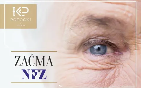 Zaćma: NFZ czy prywatnie? Gdzie najlepiej operować? Poradnik