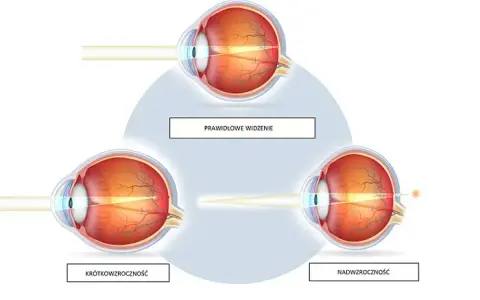 Krótkowzroczność vs. dalekowzroczność: zrozum, koryguj, zobacz lepiej