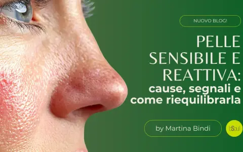 Primo piano di un volto con arrossamento su una guancia, evidenziando la pelle sensibile. La pelle è l'organo più esteso, e questo blog ne parla.