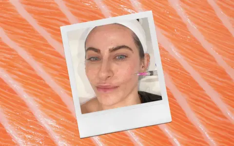 A woman receives a cosmetic injection, possibly part of a salmon sperm facial treatment, against a backdrop of salmon flesh.