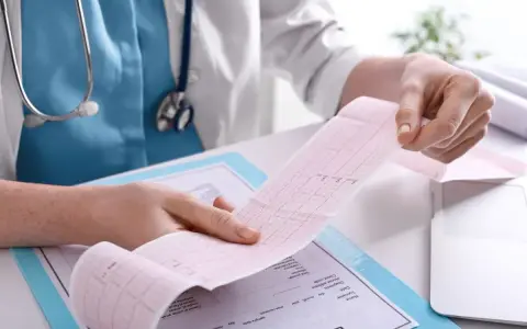 Pielęgniarka analizuje zapis EKG, ucząc się interpretacji podczas kursu EKG dla pielęgniarek online.