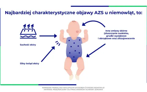 Objawy AZS u niemowląt: suchość i silny świąd skóry, inne zmiany skórne. Karmienie piersią to najlepszy sposób żywienia.