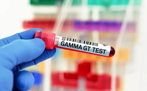Ręka w niebieskiej rękawiczce trzyma probówkę z krwią oznaczoną "GAMMA GT TEST". To badanie ocenia poziom enzymu gamma-glutamylotranspeptydazy.