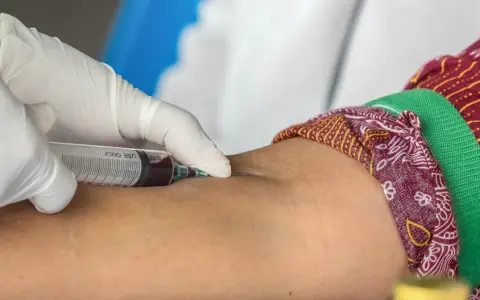 Pobieranie krwi do badań, by sprawdzić, czy cholesterol HDL norma jest prawidłowa.