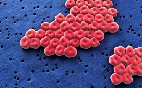 Acinetobacter baumannii, batterio resistente, si guarisce. Globuli rossi rossi su sfondo blu con piccoli fori.