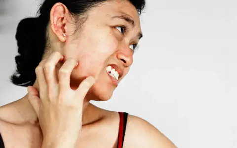 Une femme se gratte le cou et le visage, visiblement gênée par une peau très sèche et des démangeaisons.