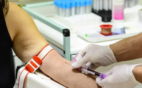 Wysokie żelazo w surowicy? Zrozum wyniki i chroń zdrowie