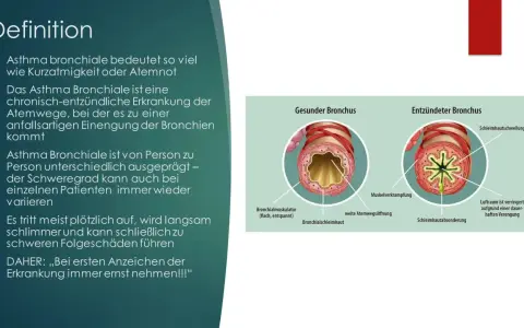 Vergleich gesunder und entzündeter Bronchien. Bei Asthma kommt es zu Muskelverkrampfungen und Schwellungen, die die Atemwege verengen.