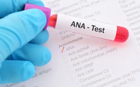 Ręka w niebieskiej rękawiczce trzyma probówkę z krwią do testu ANA. Na formularzu zaznaczono ANA.