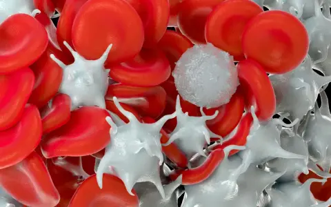 Czerwone krwinki i białe płytki krwi, które mogą wskazywać na podwyższone płytki krwi po infekcji.