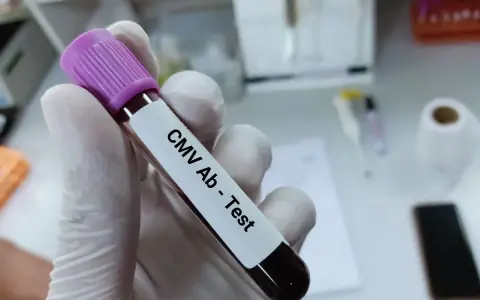 Rękawiczka laboratoryjna trzyma probówkę z krwią do testu CMV Ab. To podstawa testów diagnostycznych.