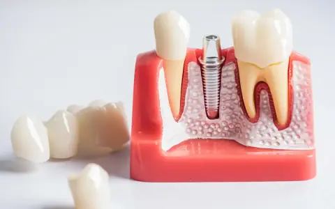 Ból po wyrwaniu ósemki: Ile trwa, co jest normą i kiedy do dentysty?