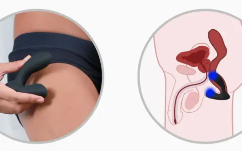 Dwa obrazy: dłoń trzymająca gadżet do masażu prostaty oraz schemat anatomiczny pokazujący jego umiejscowienie.