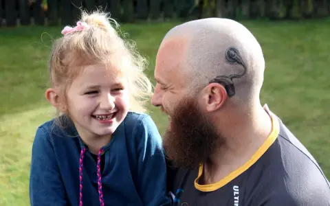 Uśmiechnięta dziewczynka i mężczyzna z tatuażem implantu ślimakowego na głowie. Rozmowa o implancie ślimakowym za i przeciw.
