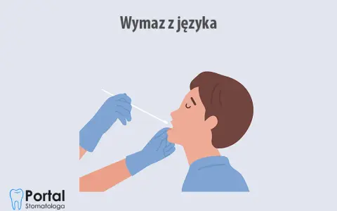 Wymaz z jamy ustnej: Co wykrywa? Bakterie, grzyby, wirusy?