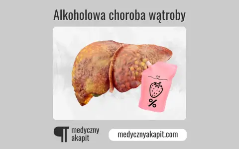 Chora wątroba i woreczek z napisem "%" sugerują, czy alkoholowe zapalenie wątroby jest wyleczalne.